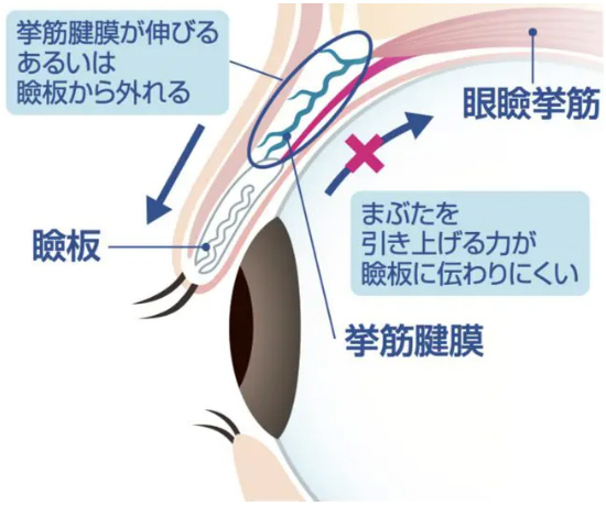 アップニーク-点眼使用前